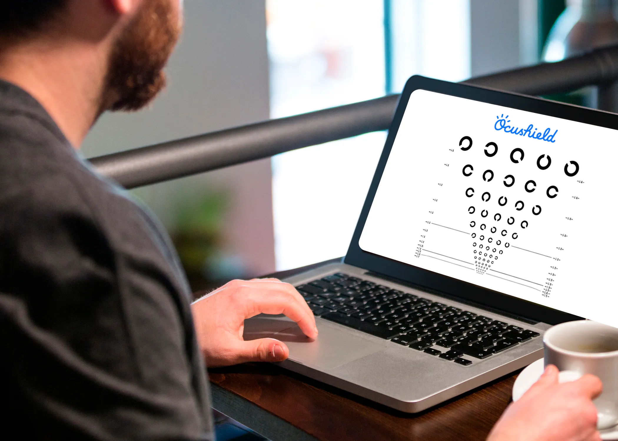 Online Eyescreening Test for Employers