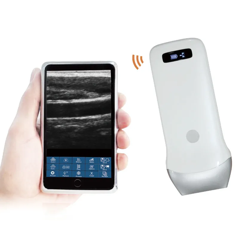 Wireless Ultrasound Probe WIFI Probe Convex / Linear Support ISO Andriod Portable Wifi-Scanner 3.5Mhz / 7.5Mhz